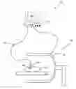 Fig. 01 - METHOD AND APPARATUS FOR TRACKING IN A MEDICAL PROCEDURE