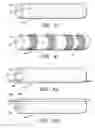 Fig. 04 - PARAMETER-SENSING ENDOTRACHEAL TUBE