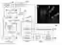 Fig. 01 - Method and apparatus for ultrasonic detection and imaging of hemodynamic information, particularly venous blood flow information
