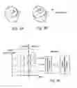 Fig. 07 - Implantable cardiac stimulator, system, device and method for monitoring cardiac synchrony