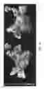Fig. 08 - Method and system for identifying cardiac arrhythmia driver sites