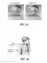 Fig. 02 - Diagnosis of asthma
