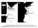 Fig. 01 - MEASUREMENT SYSTEM FOR EVALUATING THE SWALLOWING PROCESS AND/OR FOR DETECTING ASPIRATION