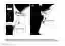 Fig. 04 - MEASUREMENT SYSTEM FOR EVALUATING THE SWALLOWING PROCESS AND/OR FOR DETECTING ASPIRATION