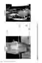 Fig. 07 - MEASUREMENT SYSTEM FOR EVALUATING THE SWALLOWING PROCESS AND/OR FOR DETECTING ASPIRATION