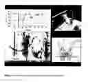 Fig. 09 - MEASUREMENT SYSTEM FOR EVALUATING THE SWALLOWING PROCESS AND/OR FOR DETECTING ASPIRATION