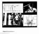 Fig. 12 - MEASUREMENT SYSTEM FOR EVALUATING THE SWALLOWING PROCESS AND/OR FOR DETECTING ASPIRATION
