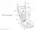 Fig. 01 - Apparatus, systems, and methods for augmenting the flow of fluid within body vessels