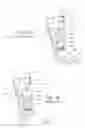 Fig. 03 - APPARATUS, SYSTEMS, AND METHODS FOR AUGMENTING THE FLOW OF FLUID WITHIN BODY VESSELS