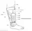 Fig. 01 - Apparatus, systems, and methods for augmenting the flow of fluid within body vessels