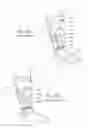 Fig. 03 - Apparatus, systems, and methods for augmenting the flow of fluid within body vessels