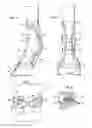 Fig. 04 - Limb protection device