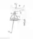 Fig. 22 - Implant device, tool, and methods relating to treatment of paranasal sinuses