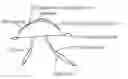 Fig. 01 - Subconjunctival conformer device and uses thereof