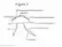 Fig. 04 - Subconjunctival conformer device and uses thereof
