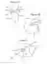 Fig. 02 - Glaucoma drainage device and uses thereof