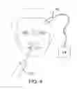 Fig. 09 - Methods and systems for toxin delivery to the nasal cavity