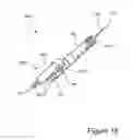 Fig. 14 - TISSUE REMOVAL DEVICES, SYSTEMS AND METHODS