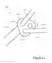 Fig. 17 - TISSUE REMOVAL DEVICES, SYSTEMS AND METHODS