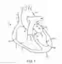 Fig. 02 - Method for providing surgical access