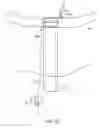 Fig. 108 - Method for providing surgical access