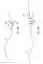 Fig. 111 - Method for providing surgical access