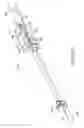 Fig. 113 - Method for providing surgical access