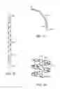 Fig. 12 - Method for providing surgical access