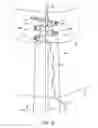 Fig. 20 - Method for providing surgical access