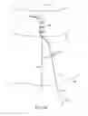 Fig. 25 - Method for providing surgical access