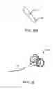Fig. 32 - Method for providing surgical access