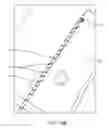 Fig. 41 - Method for providing surgical access
