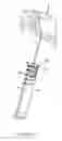 Fig. 46 - Method for providing surgical access