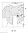 Fig. 51 - Method for providing surgical access