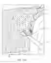 Fig. 52 - Method for providing surgical access