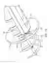 Fig. 72 - Method for providing surgical access