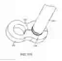 Fig. 73 - Method for providing surgical access