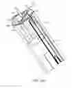 Fig. 77 - Method for providing surgical access