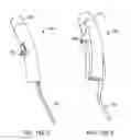 Fig. 96 - Method for providing surgical access