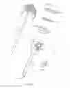 Fig. 06 - Trocar seal with retraction induced hinge