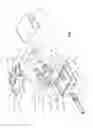 Fig. 03 - External end device for permanent catheters