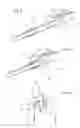Fig. 07 - External end device for permanent catheters