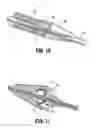 Fig. 08 - Surgical fluid transfer apparatus