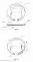 Fig. 02 - Intraocular drug delivery device and associated methods