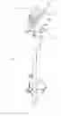Fig. 01 - Apparatus for use in arthroplasty on a knee joint