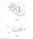 Fig. 03 - Apparatus for use in arthroplasty on a knee joint