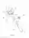 Fig. 20 - Apparatus for use in arthroplasty on a knee joint