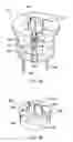 Fig. 06 - Surgical manipulator for a telerobotic system