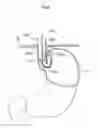 Fig. 07 - STOMACH INSTRUMENT AND METHOD
