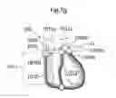 Fig. 09 - STOMACH INSTRUMENT AND METHOD